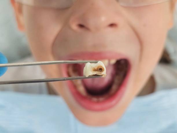 Best Emergency Denture Repair in Garberville, CA